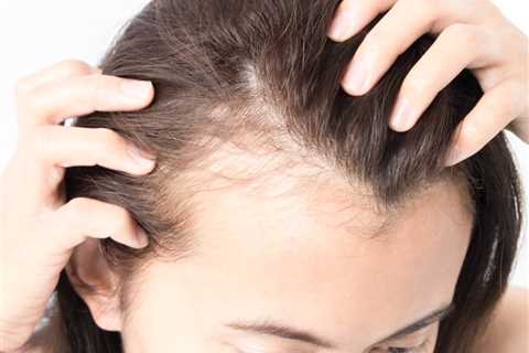 Reviewers Are Raving Over This 3-Step System That Fights Thinning Hair