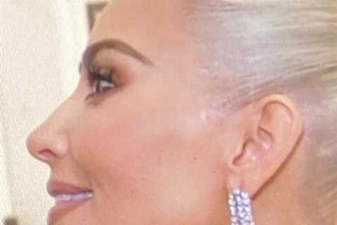 Kardashian fans mock Kim after new unedited photo uncovers star’s hidden ‘face tape’ used to lift..