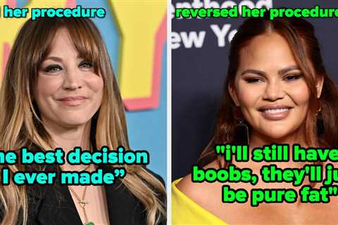 11 Famous People Who Stand By Their Cosmetic Procedures And 11 Celebs Who Had Theirs Totally..