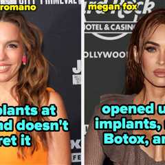 21 Famous People Who Opened Up About Why They Got Plastic Surgery And Injectables, And If They..
