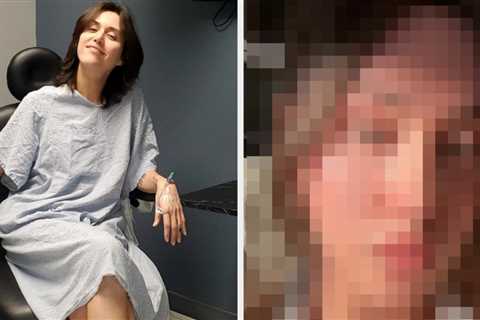 3 Months After Undergoing Facial Feminization Surgery, Drag Race Star Adore Delano Has Posted Her..