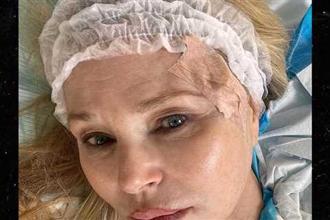 Christie Brinkley Reveals Skin Cancer Diagnosis, Shares Surgery Photos
