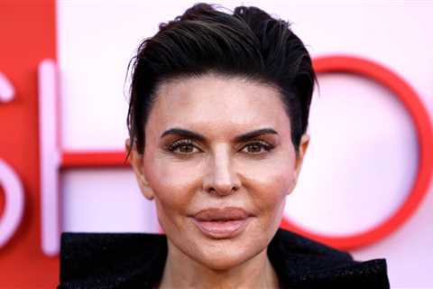 After A Viral Video Called Out Lisa Rinna's Overfilled Cheeks, She Directly Responded In The..