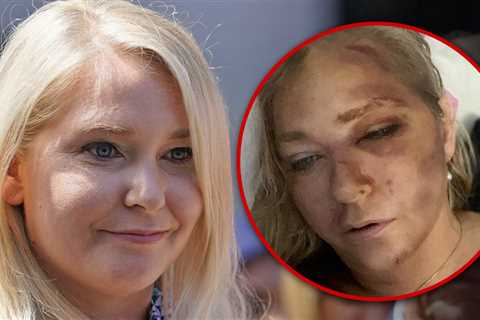 Epstein Accuser Virginia Giuffre Leaves Hospital After '4 Days to Live' Prediction