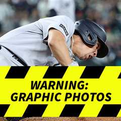 Yankees' Oswaldo Cabrera Suffers Gruesome Injury, Taken Off Field In Ambulance