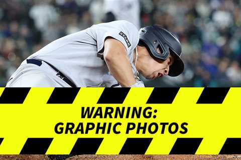 Yankees' Oswaldo Cabrera Suffers Gruesome Injury, Taken Off Field In Ambulance