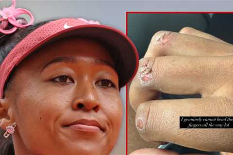 Naomi Osaka Shows Off Gnarly Blisters, Opens Up On Wanting Tennis Break