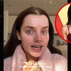 Kylie Jenner Details Her Boob Job, Spills Exactly What She Received From Surgeon