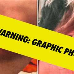 Bryana Bongolan's Alleged Injury Photos From Diddy Balcony Incident Filed As Evidence
