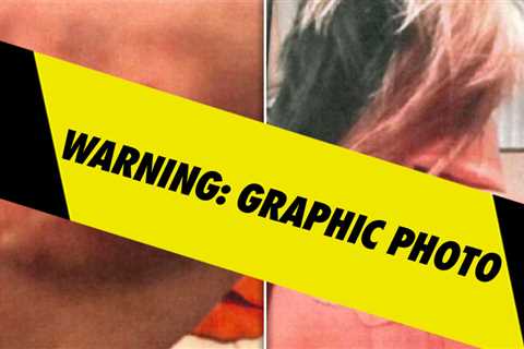 Bryana Bongolan's Alleged Injury Photos From Diddy Balcony Incident Filed As Evidence
