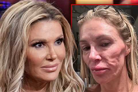 Brandi Glanville Says She's Finally Getting Answers About Her Facial Disfigurement