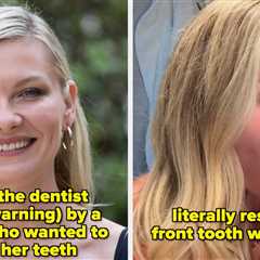7 Celebrities Who Have Been Praised For Their “Unique” Smiles In Hollywood After Refusing To “Fix”..