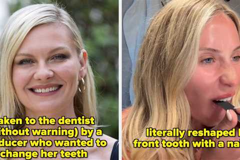 7 Celebrities Who Have Been Praised For Their “Unique” Smiles In Hollywood After Refusing To “Fix”..