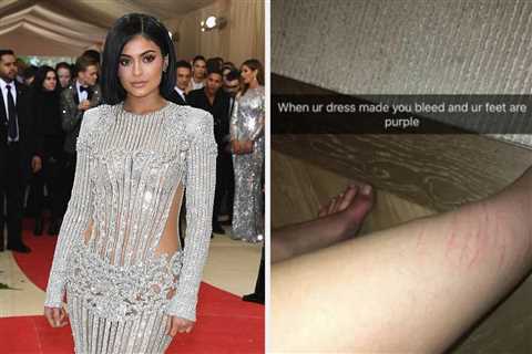16 Times Celebs Took Beauty Is Pain Wayyy Too Seriously And Wore Red Carpet Looks That Physically..
