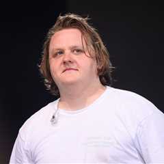 Lewis Capaldi’s Comeback to Continue With Two Huge Outdoor U.K. Shows In 2026