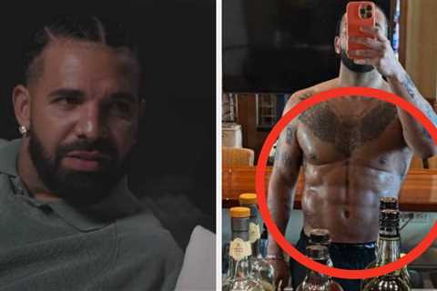 After Years Of Speculation, Drake Addressed All Those Plastic Surgery Rumors And Made A Big..