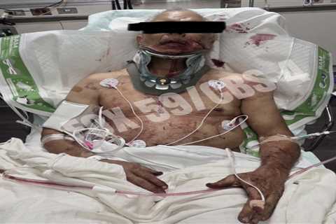 Family of grease truck driver brutally bashed by Mark Sanchez give update on his condition