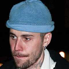 Justin Bieber Hurts Ribs in Electric Skateboard Fail