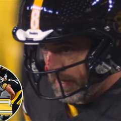 Aaron Rodgers left bloodied by  viscous Joey Bosa hit that sparked Steelers injury scare