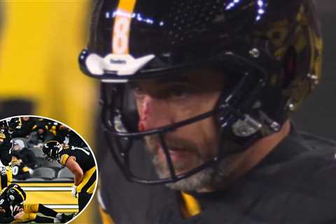 Aaron Rodgers left bloodied by  viscous Joey Bosa hit that sparked Steelers injury scare