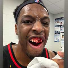 Bloodied Onyeka Okongwu shows off gruesome injury after taking elbow to face