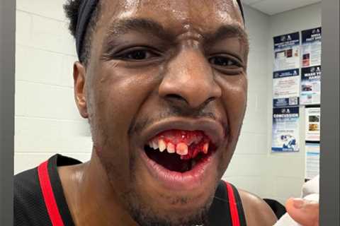Bloodied Onyeka Okongwu shows off gruesome injury after taking elbow to face