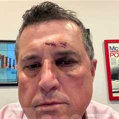 'Reacher' Star Alan Ritchson's Fight Opponent Shows Huge Shiner in New Pics