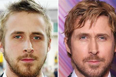 Ryan Gosling Good Genes or Good Docs?!