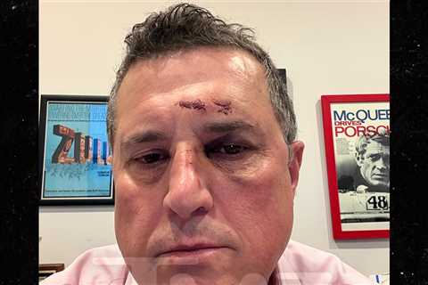 'Reacher' Star Alan Ritchson's Fight Opponent Shows Huge Shiner in New Pics