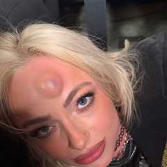 Liv Morgan Shows Off Nasty Bump After Clashing Heads On WWE 'Monday Night Raw'