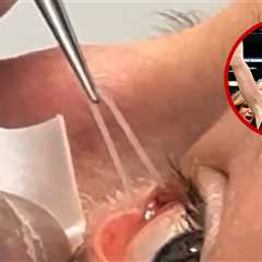 UFC's Rose Namajunas Shares Gruesome Footage of Silicone Tube Removal From Eye