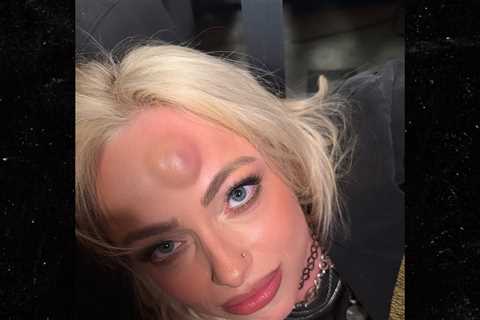 Liv Morgan Shows Off Nasty Bump After Clashing Heads On WWE 'Monday Night Raw'