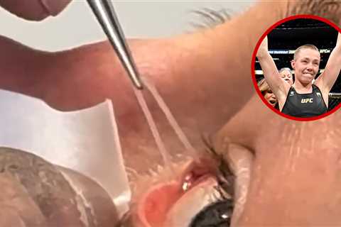 UFC's Rose Namajunas Shares Gruesome Footage of Silicone Tube Removal From Eye