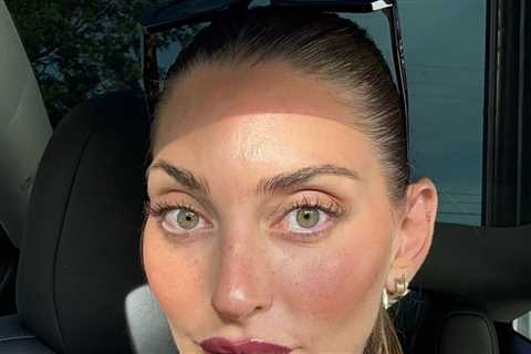 Influencer Who Had Heart Surgery While Pregnant Opens Up About Baby's Death