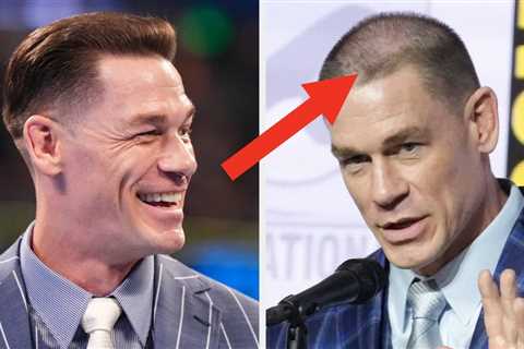 After Breaking Down The Intense Details Of His Back-To-Back Hair Transplants, People Are Stunned By ..