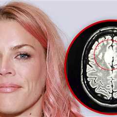 Busy Philipps Says She Needed Multiple Surgeries To Remove Rare Brain Tumor