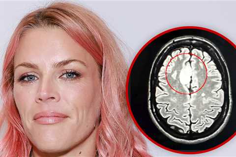 Busy Philipps Says She Needed Multiple Surgeries To Remove Rare Brain Tumor