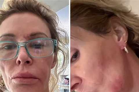 Brandi Glanville's Friend Launches GoFundMe for Her Health Issues